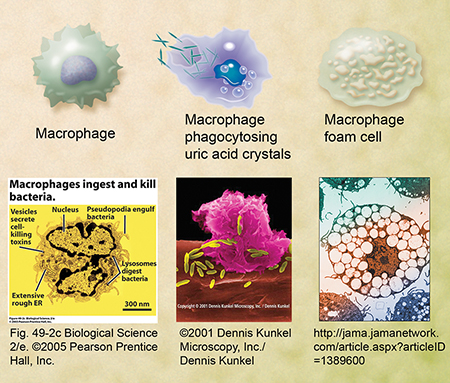 Macrophages, foam cells