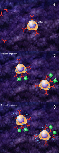 Allergic response cascade, antibody binding in allergic reaction, B cells releasing cytokines in allergic reaction, Type I hypersensitivity