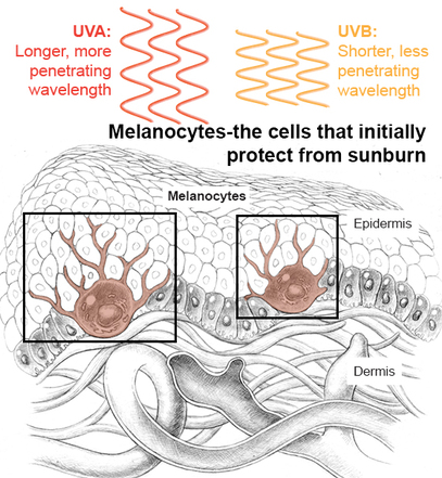 Sunburn damage on cells, melanocytes, UVA versus UVB