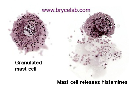 Mast cell releasing histamines