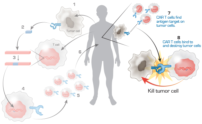 CAR T cell immunotherapy