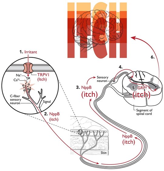 Cellular itch response, C-fiber sensory neuron, NppB